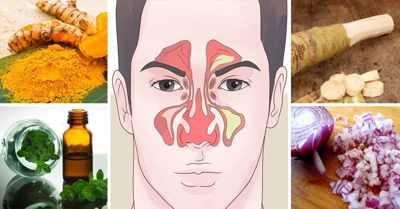 Home remedies for sinus infection