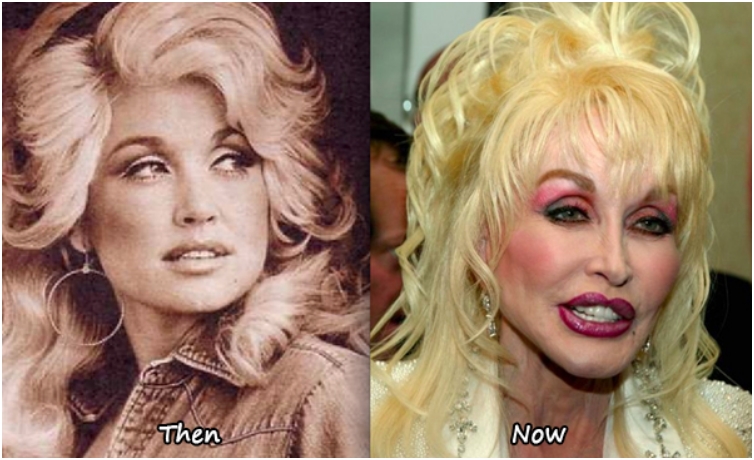 25 Once Beautiful Celebs With Horrible Plastic Surgery Jobs