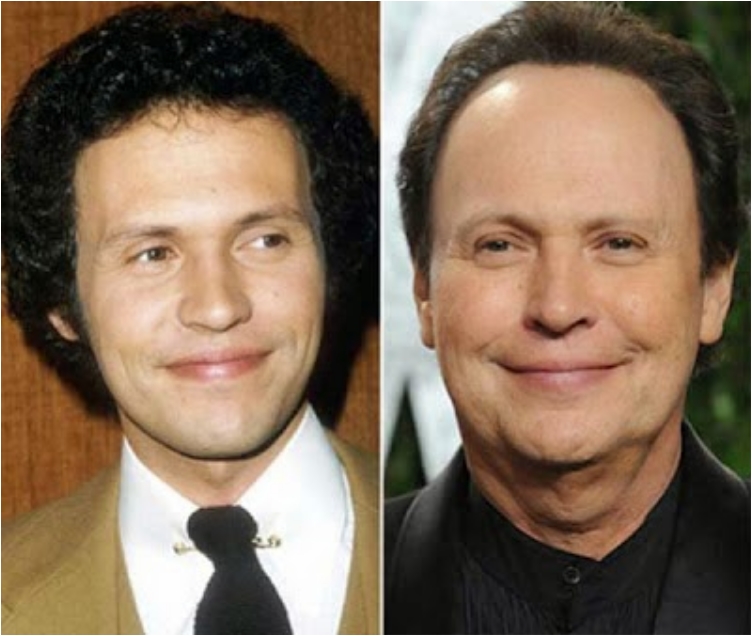 50 Famous Men Who Have Done Plastic Surgery