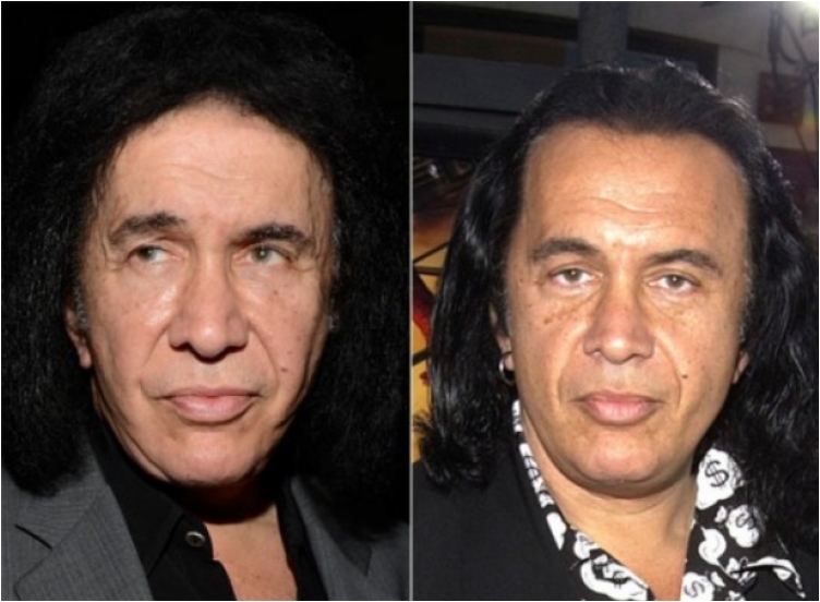 50 Famous Men Who Have Done Plastic Surgery Ritely