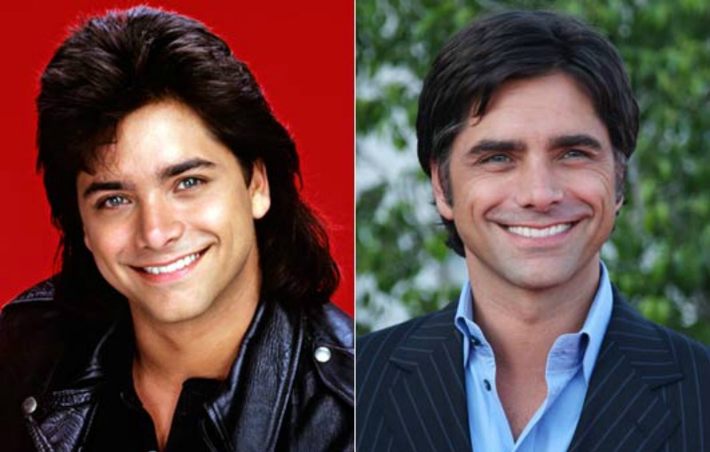 free john stamos plastic surgery