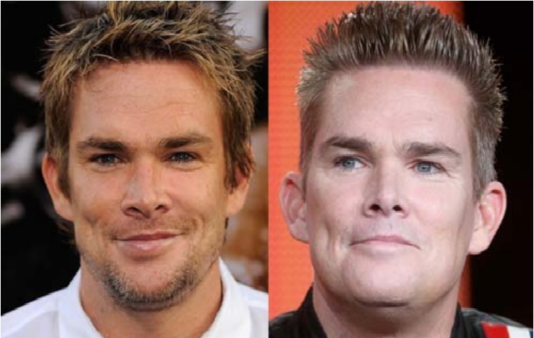 Famous Men Who Have Done Plastic Surgery Ritely