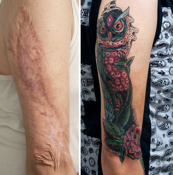 35 beautiful tattoos to cover scars ritely 35 beautiful tattoos to cover scars ritely