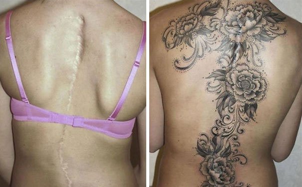 35 Beautiful Tattoos to Cover Scars