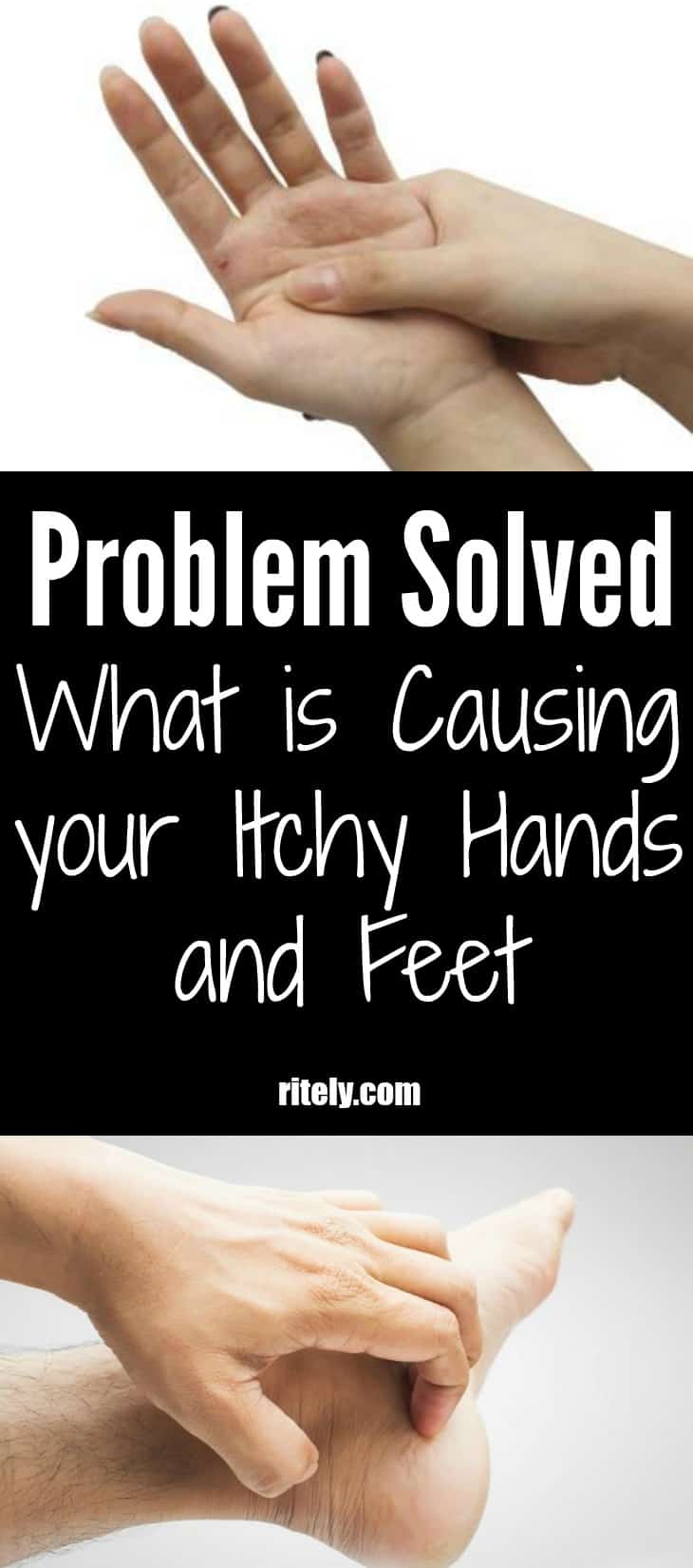 Problem Solved: What is Causing your Itchy Hands and Feet