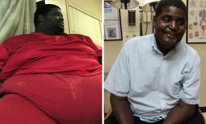 24 Before and After Photos from 'My 600 lb.-Life' that Will Make You Regret Regarding Yourself Fat