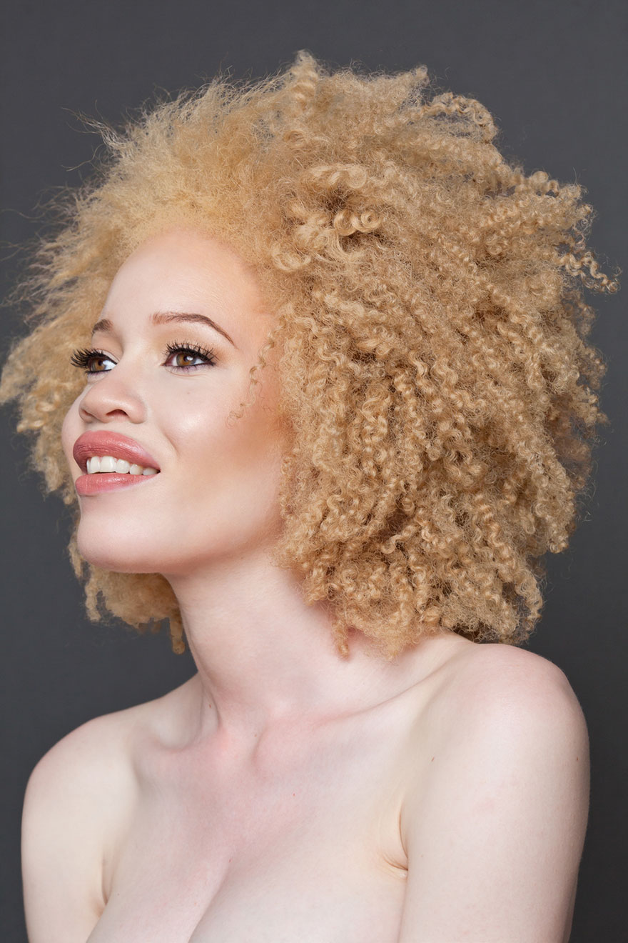 Looking at These 20 Photos of Beautiful Albino People will Hypnotize You