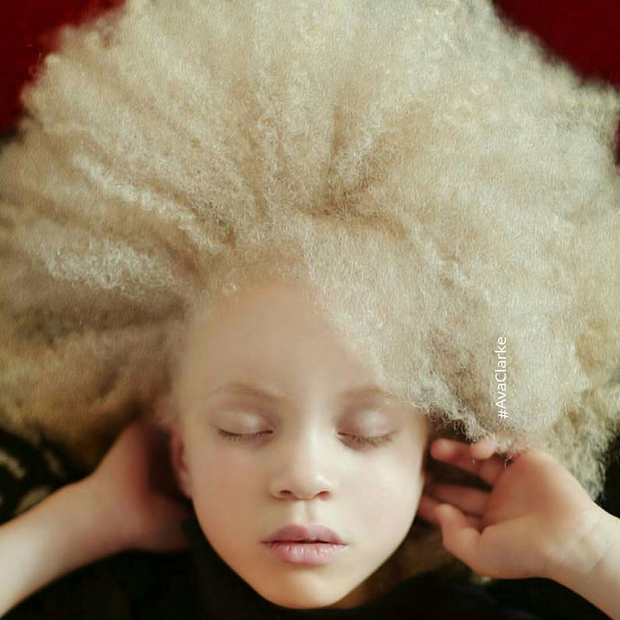 Looking at These 20 Photos of Beautiful Albino People will Hypnotize You