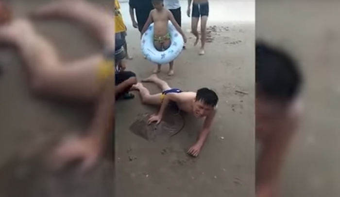 This Chinese Man's Vacation Goes Wrong After Stingray Stings His Penis