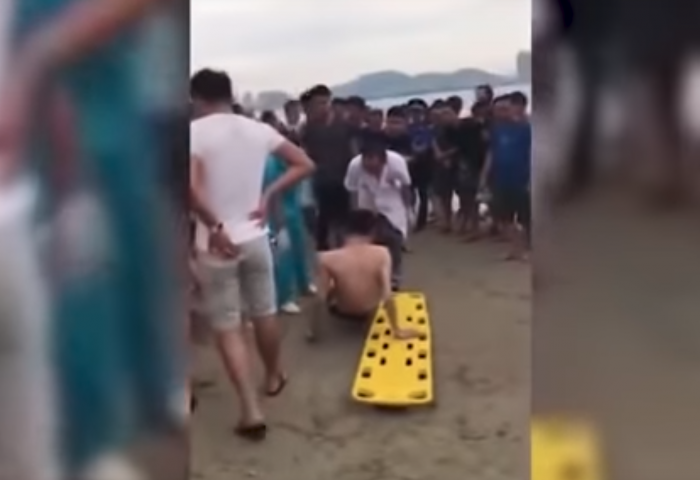 This Chinese Man's Vacation Goes Wrong After Stingray Stings His Penis