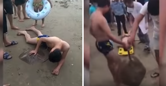 This Chinese Man's Vacation Goes Wrong After Stingray Stings His Penis